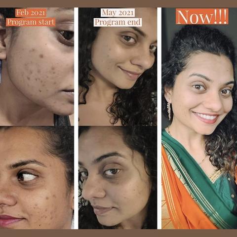 Client skin before and after, February to May 2021